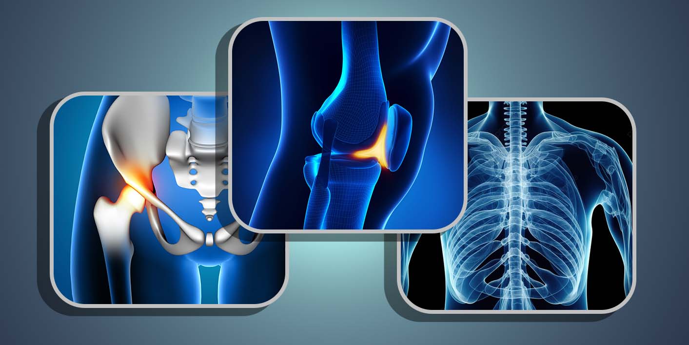 МРТ Шаболовская